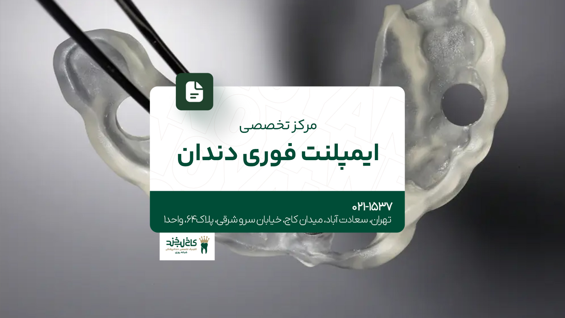  مرکز تخصصی ایمپلنت فوری دندان