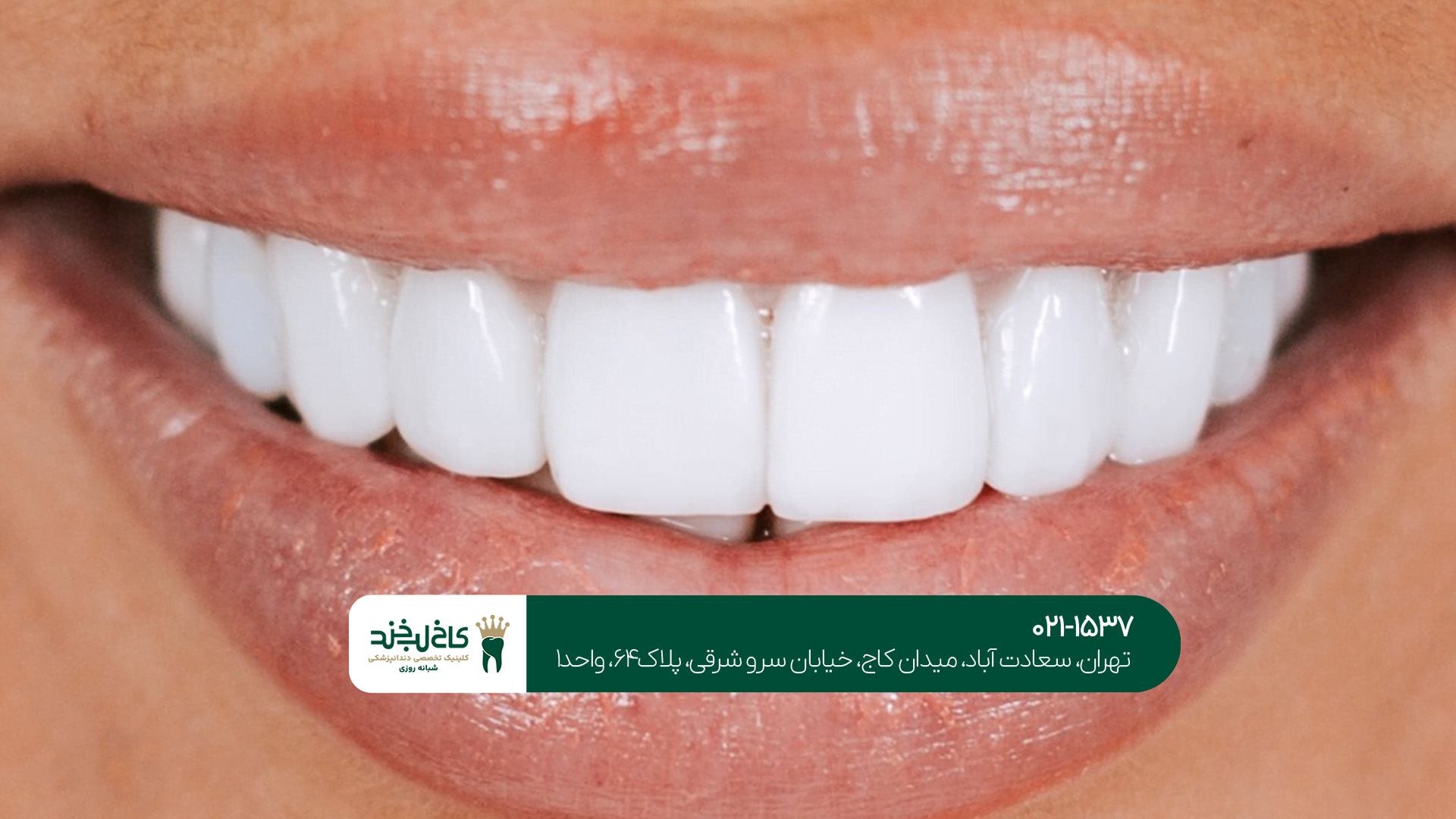 مرکز تخصصی طراحی لبخند طبیعی مرکز تخصصی طراحی لبخند طبیعی