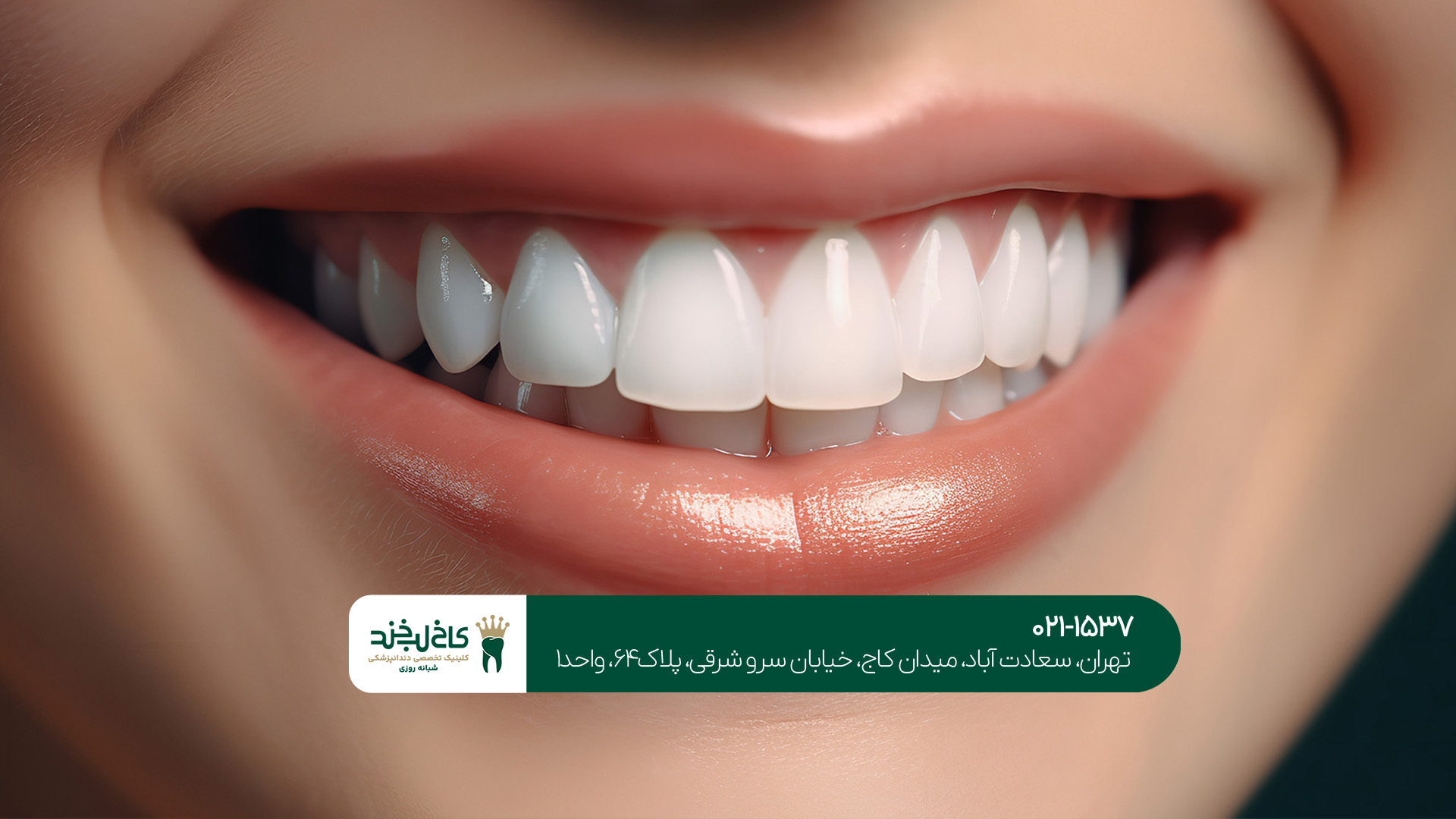 مرکز تخصصی طراحی لبخند طبیعی مرکز تخصصی طراحی لبخند طبیعی