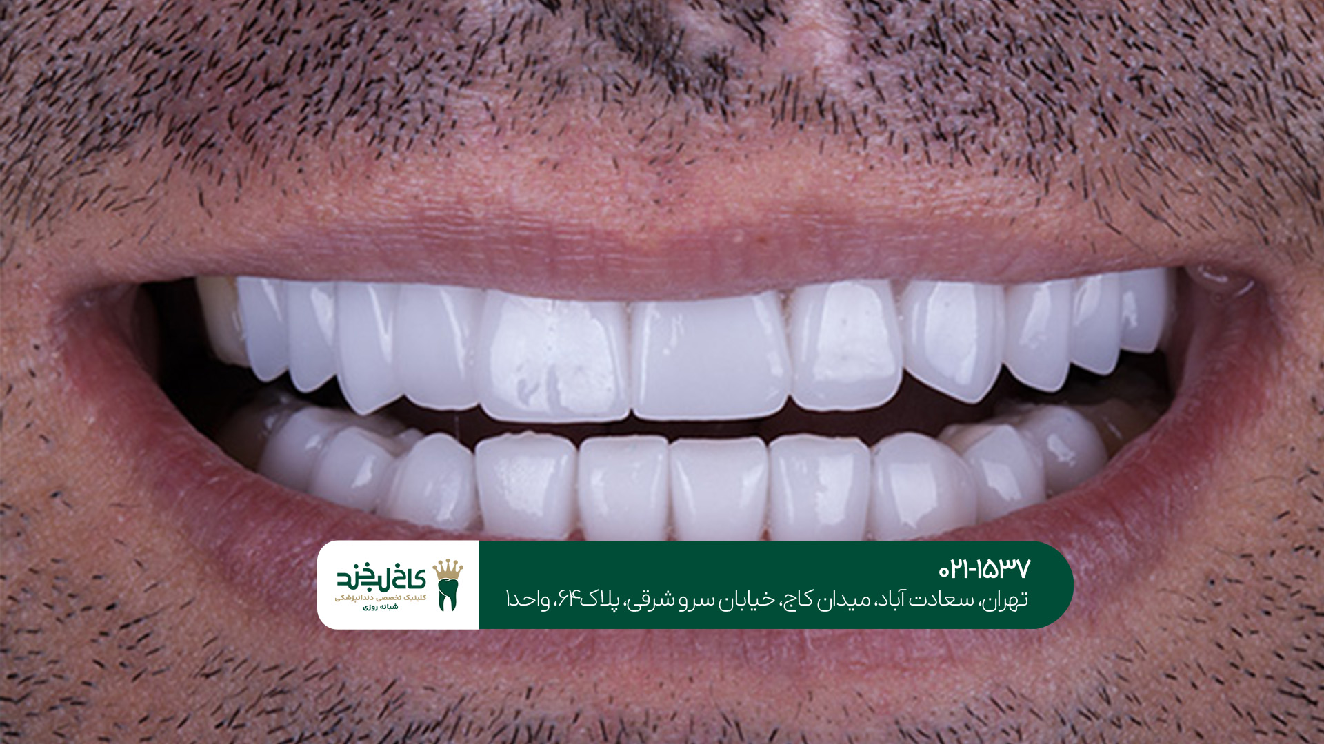 مرکز تخصصی کامپوزیت مرکز تخصصی کامپوزیت