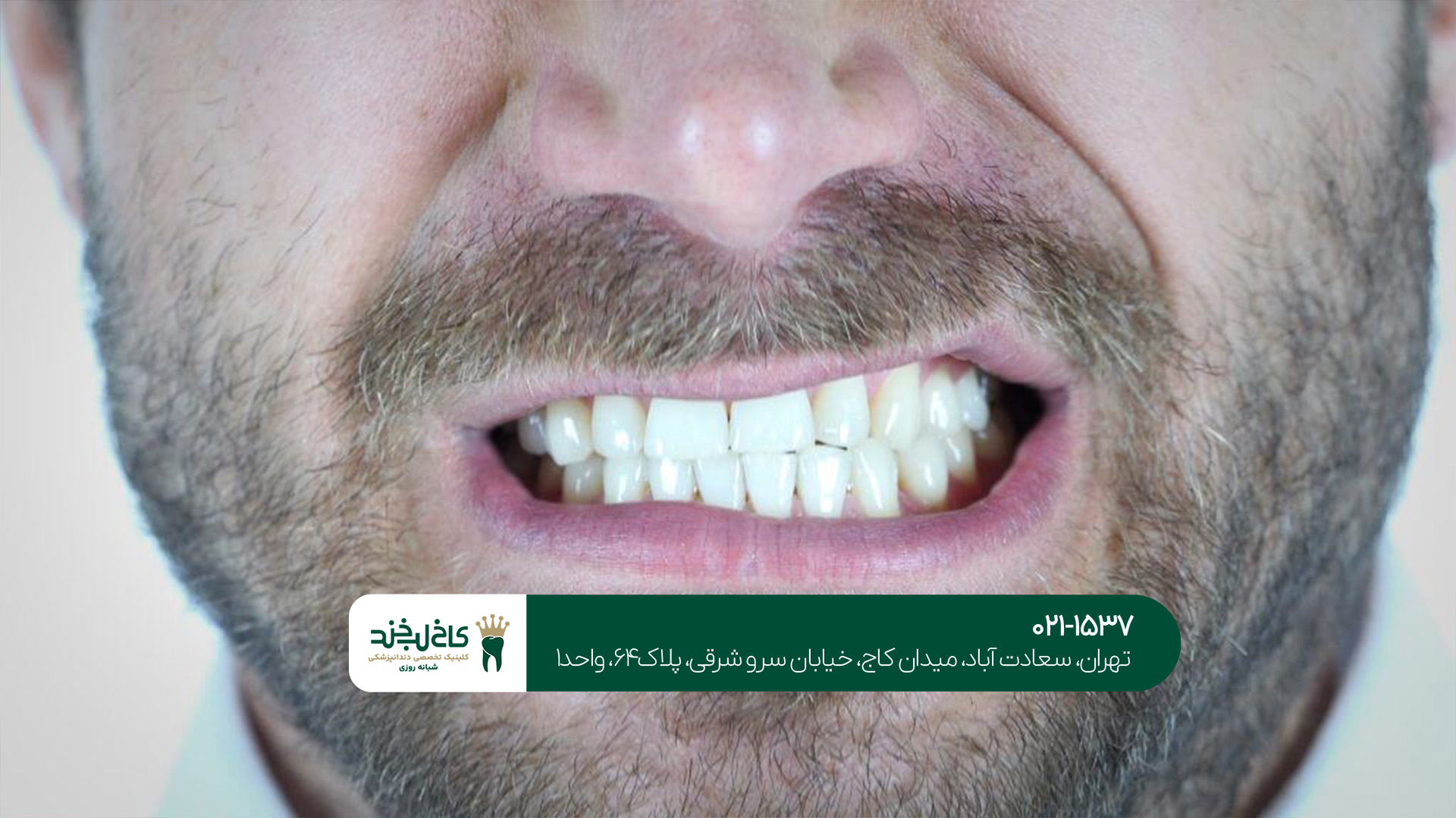 مرکز تخصصی کامپوزیت مرکز تخصصی کامپوزیت