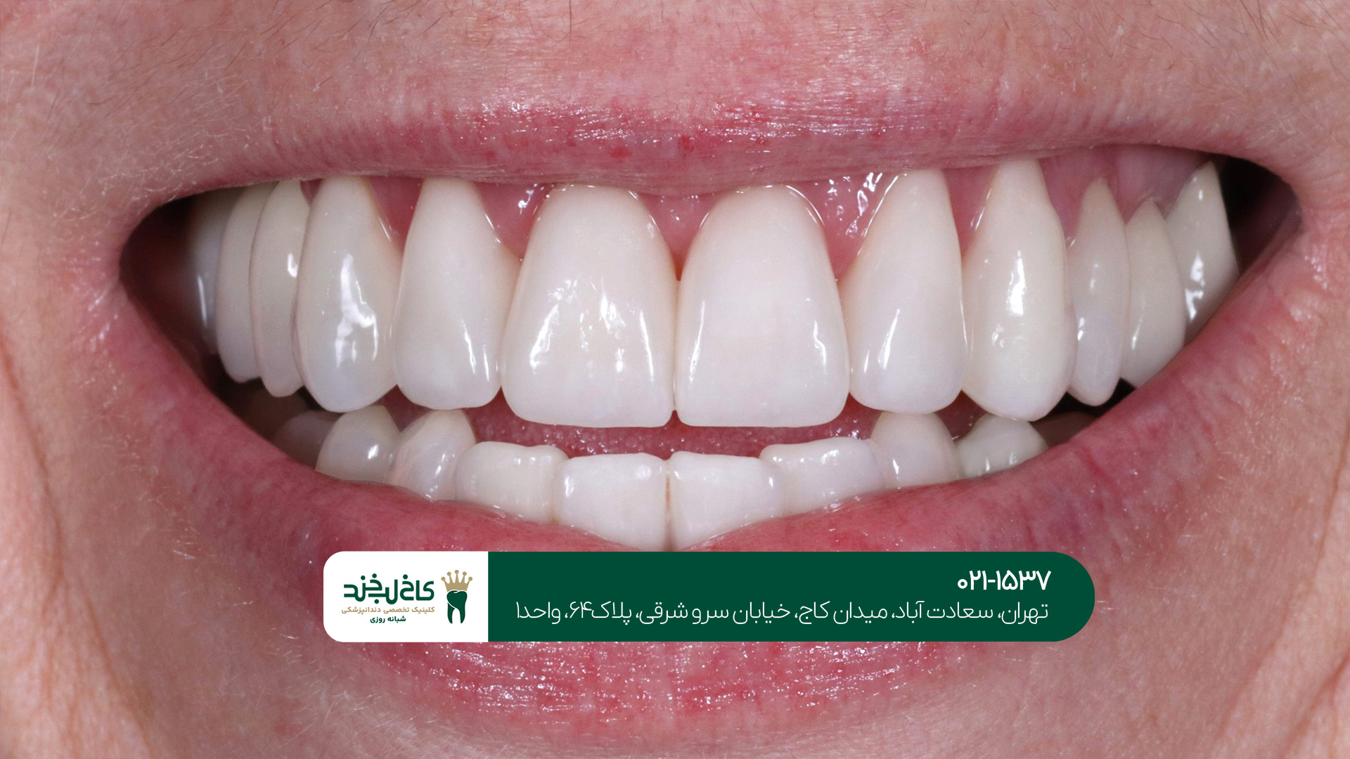 مرکز تخصصی کامپوزیت مرکز تخصصی کامپوزیت