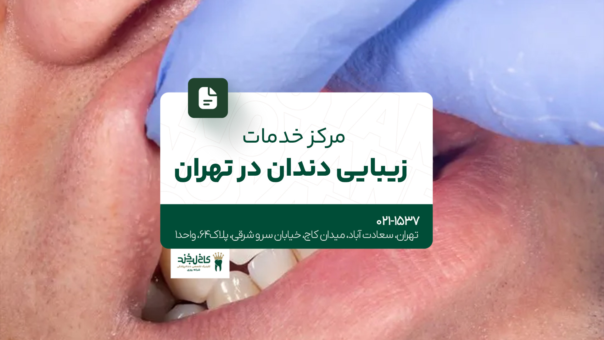 مرکز خدمات زیبایی دندان در تهران