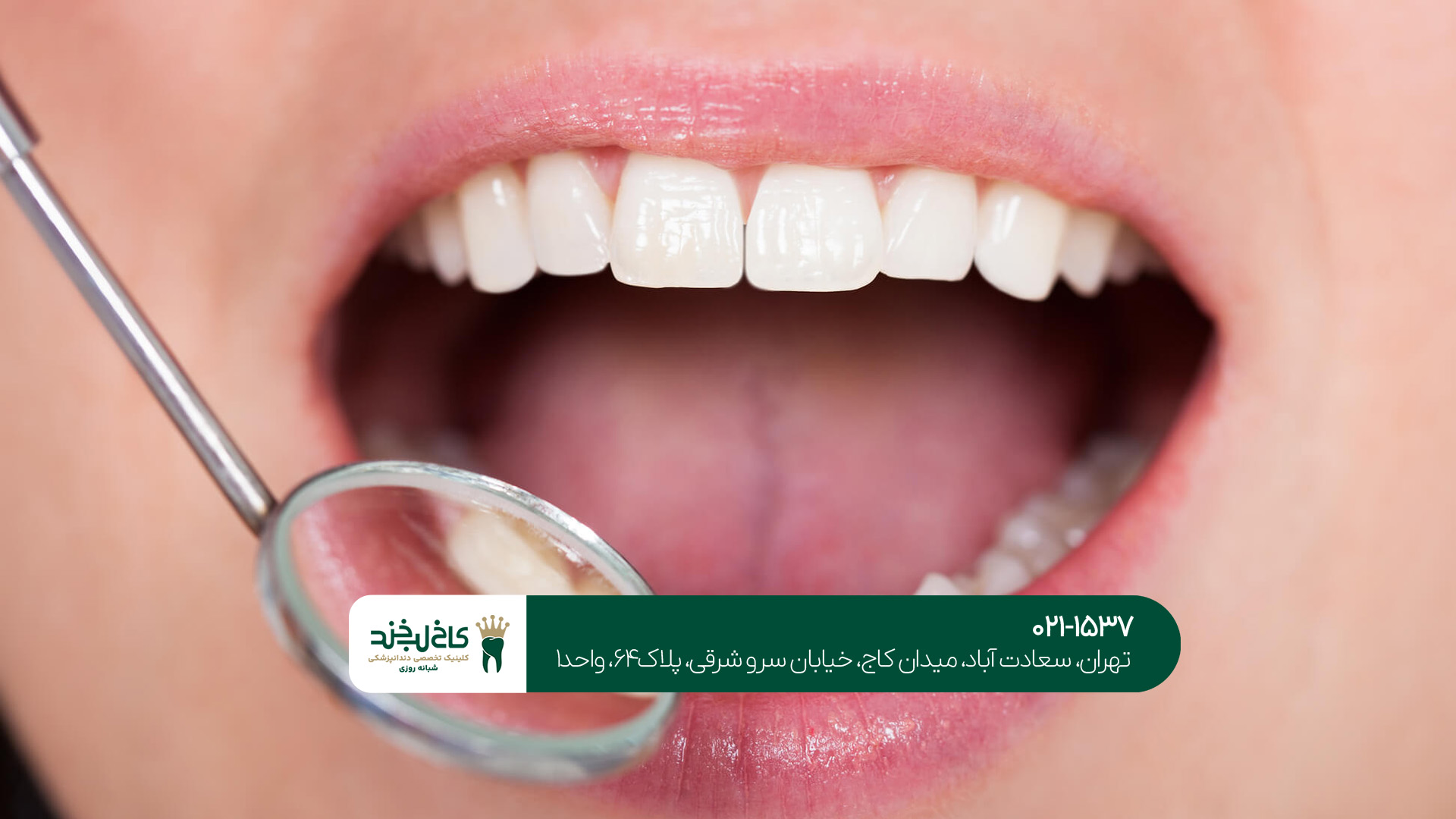 مرکز دندانپزشکی زیبایی مرکز دندانپزشکی زیبایی