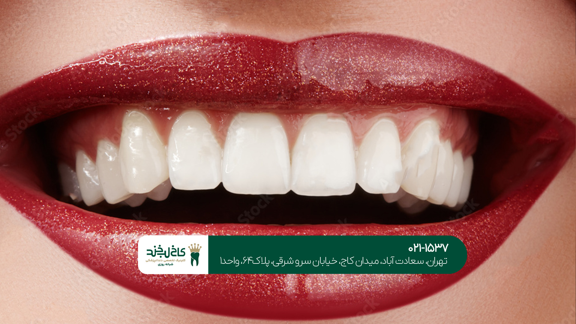 مرکز دندانپزشکی زیبایی مرکز دندانپزشکی زیبایی