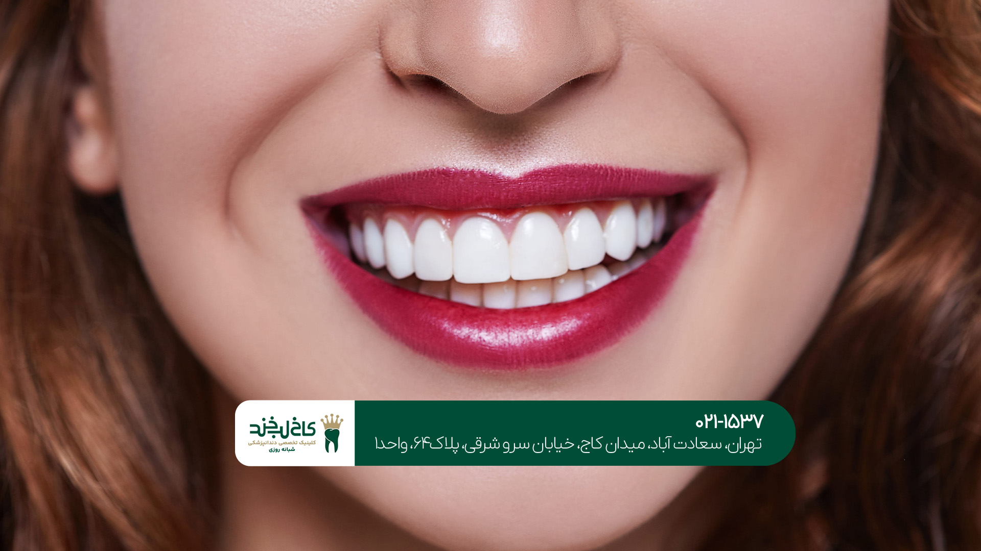 مرکز دندانپزشکی زیبایی مرکز دندانپزشکی زیبایی