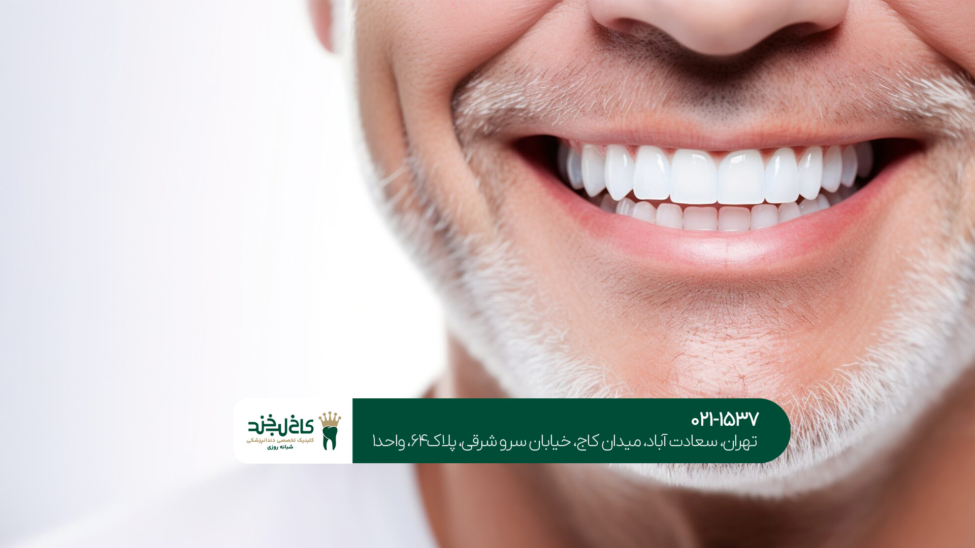 مرکز زیبایی دندان در تهران مرکز زیبایی دندان در تهران