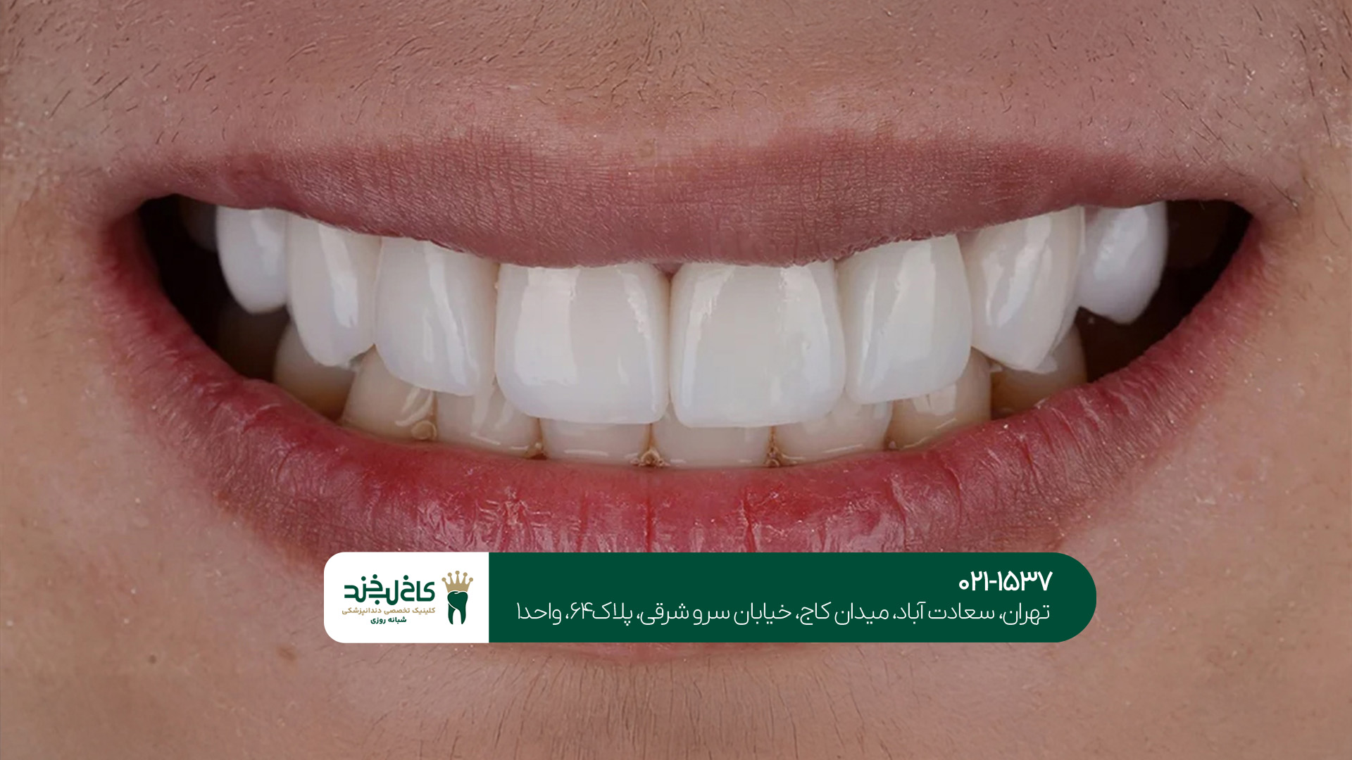 مرکز زیبایی دندان در تهران مرکز زیبایی دندان در تهران