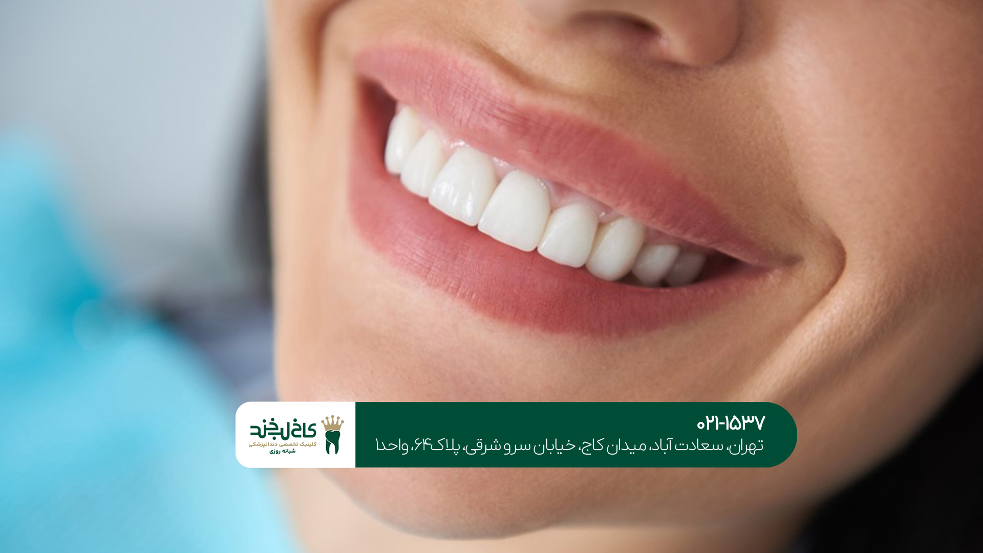 مرکز زیبایی دندان در تهران مرکز زیبایی دندان در تهران