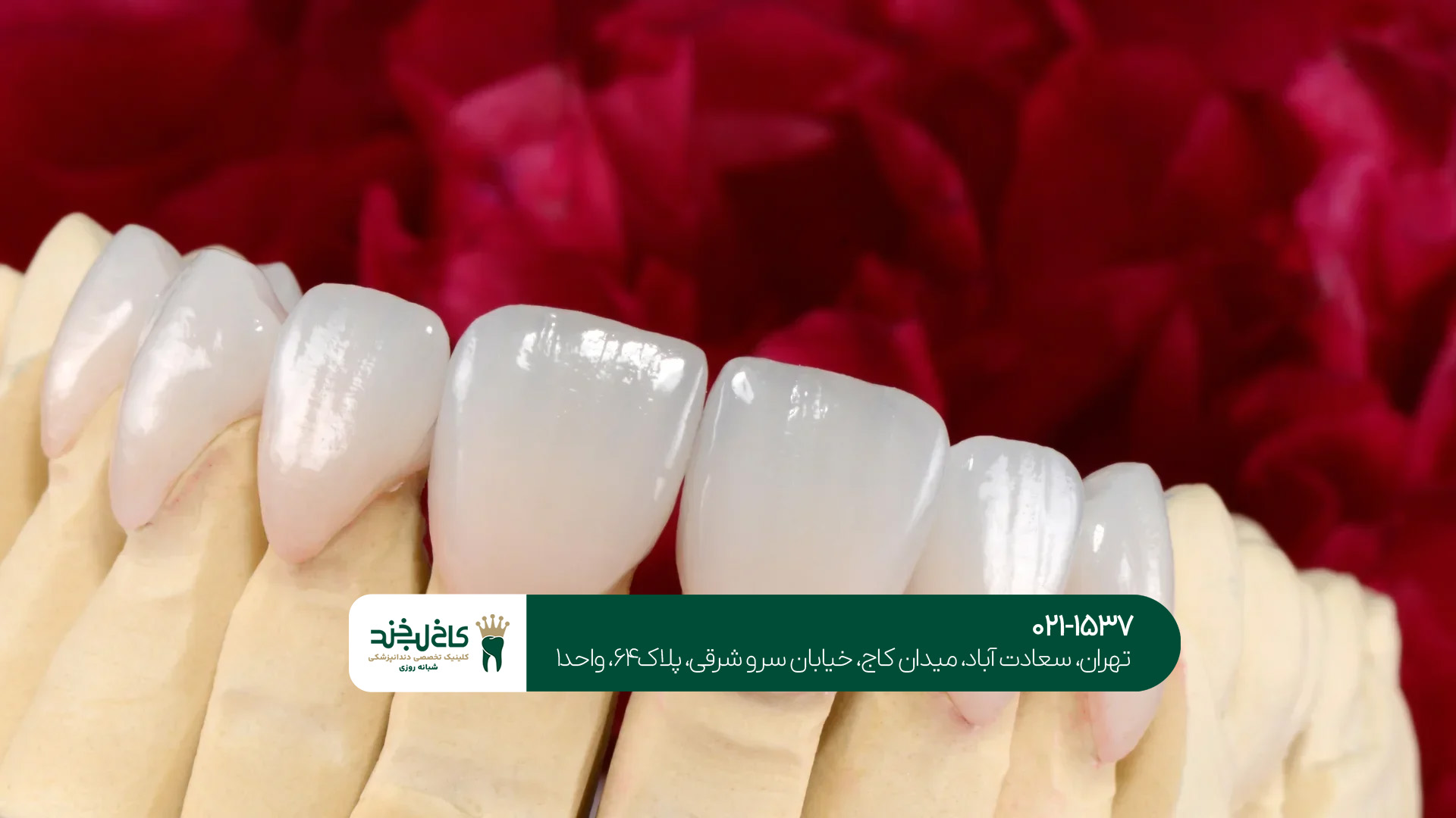 مرکز لمینت حرفه‌ای در تهران