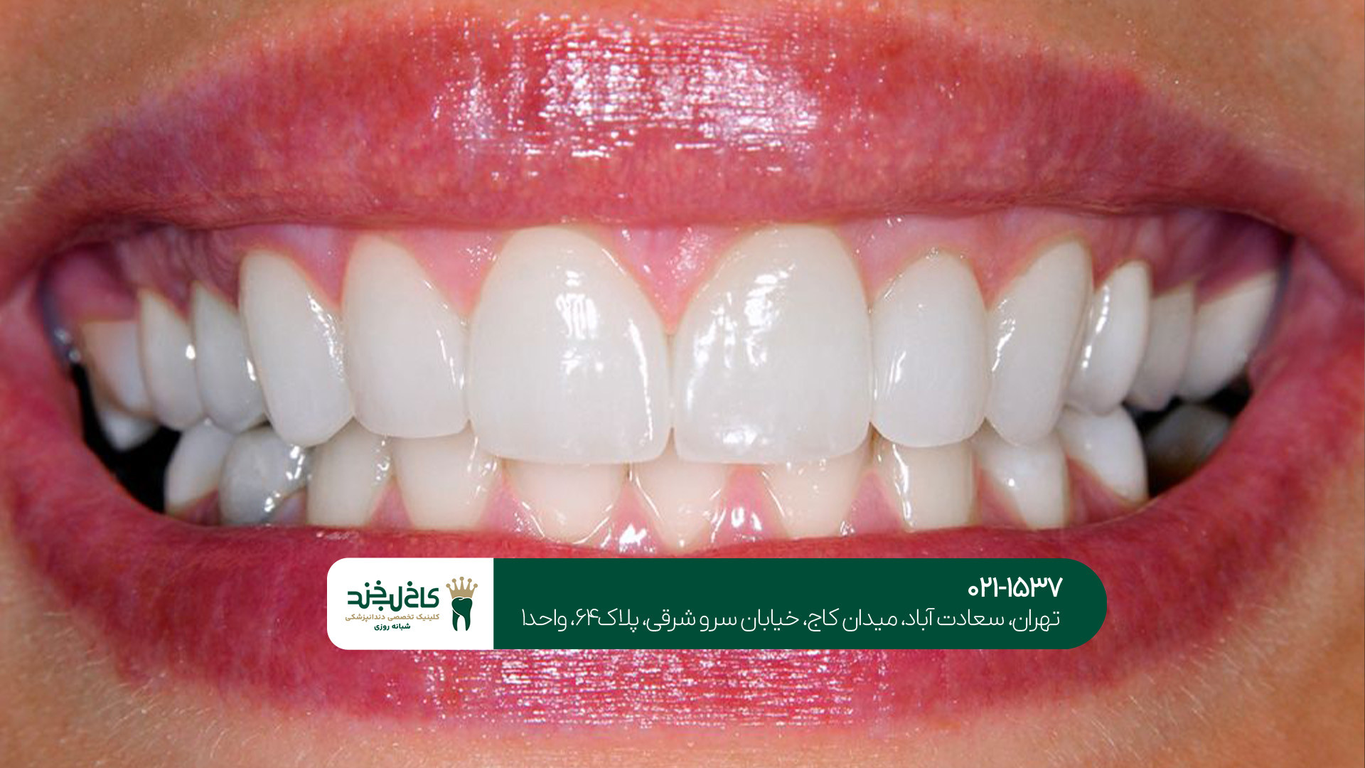 مرکز لمینت حرفه‌ای در تهران