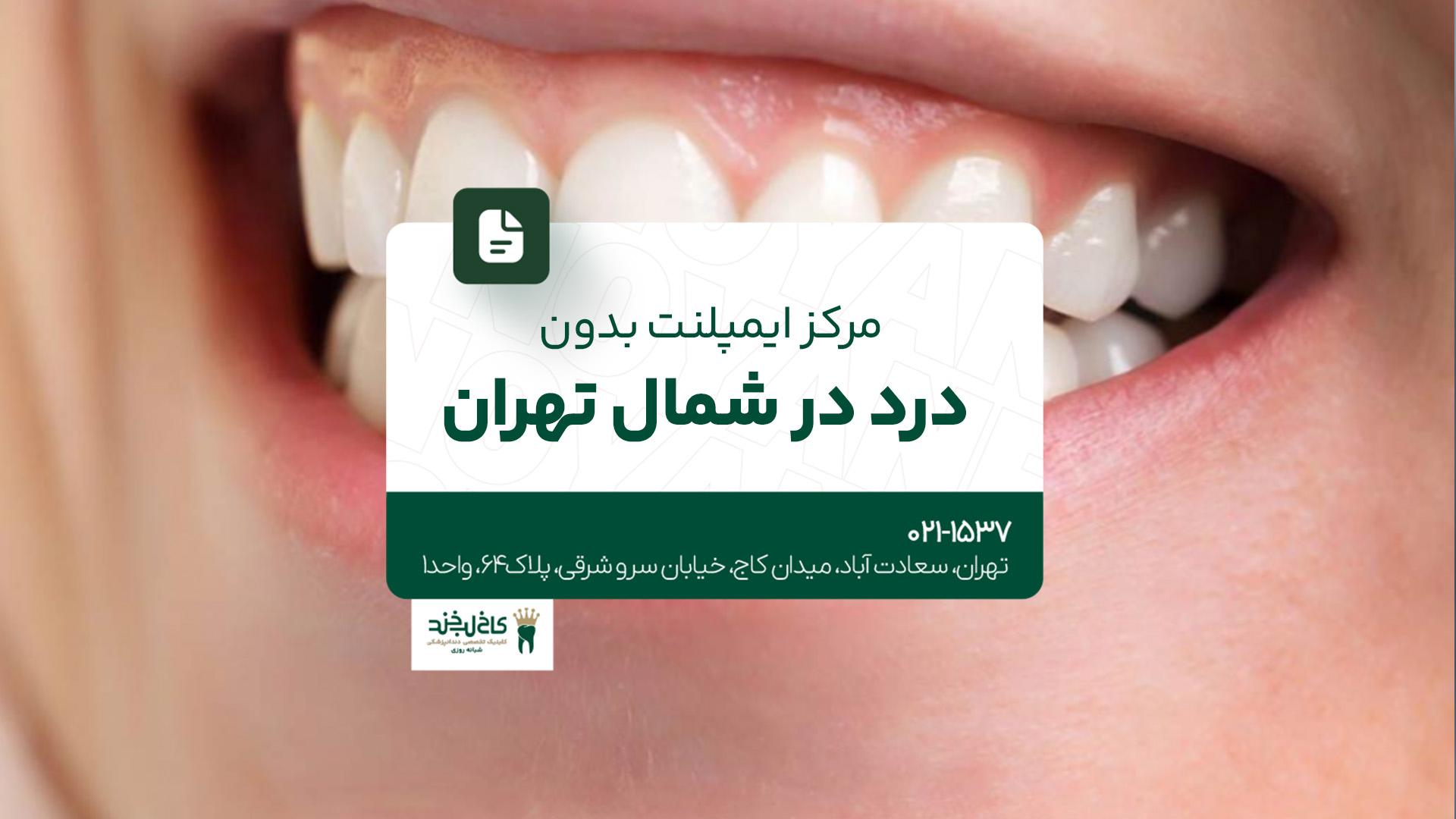 مرکز ایمپلنت بدون درد در شمال تهران مرکز ایمپلنت بدون درد در شمال تهران