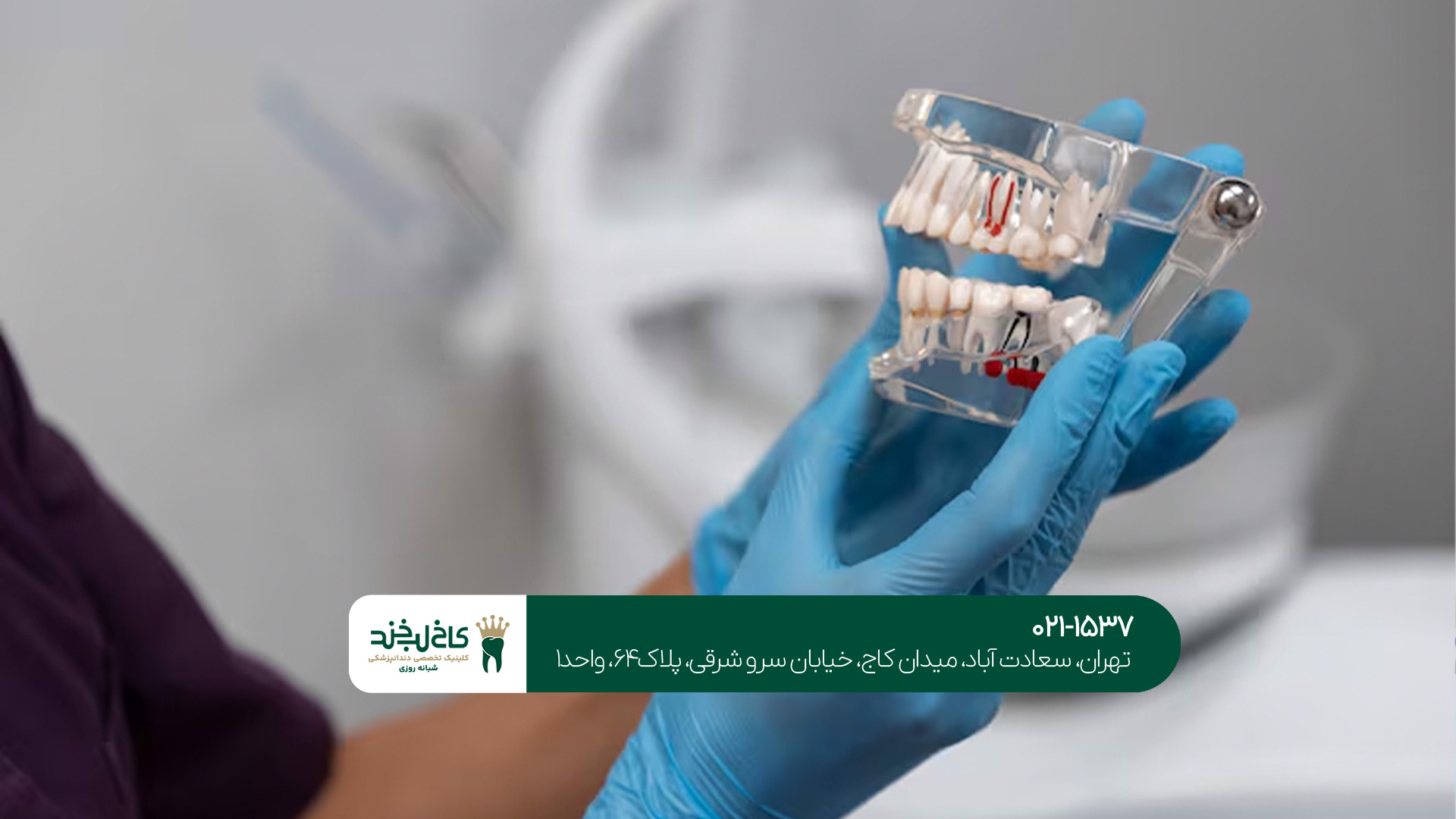 مرکز تخصصی ایمپلنت دیجیتال تهران مرکز تخصصی ایمپلنت دیجیتال تهران