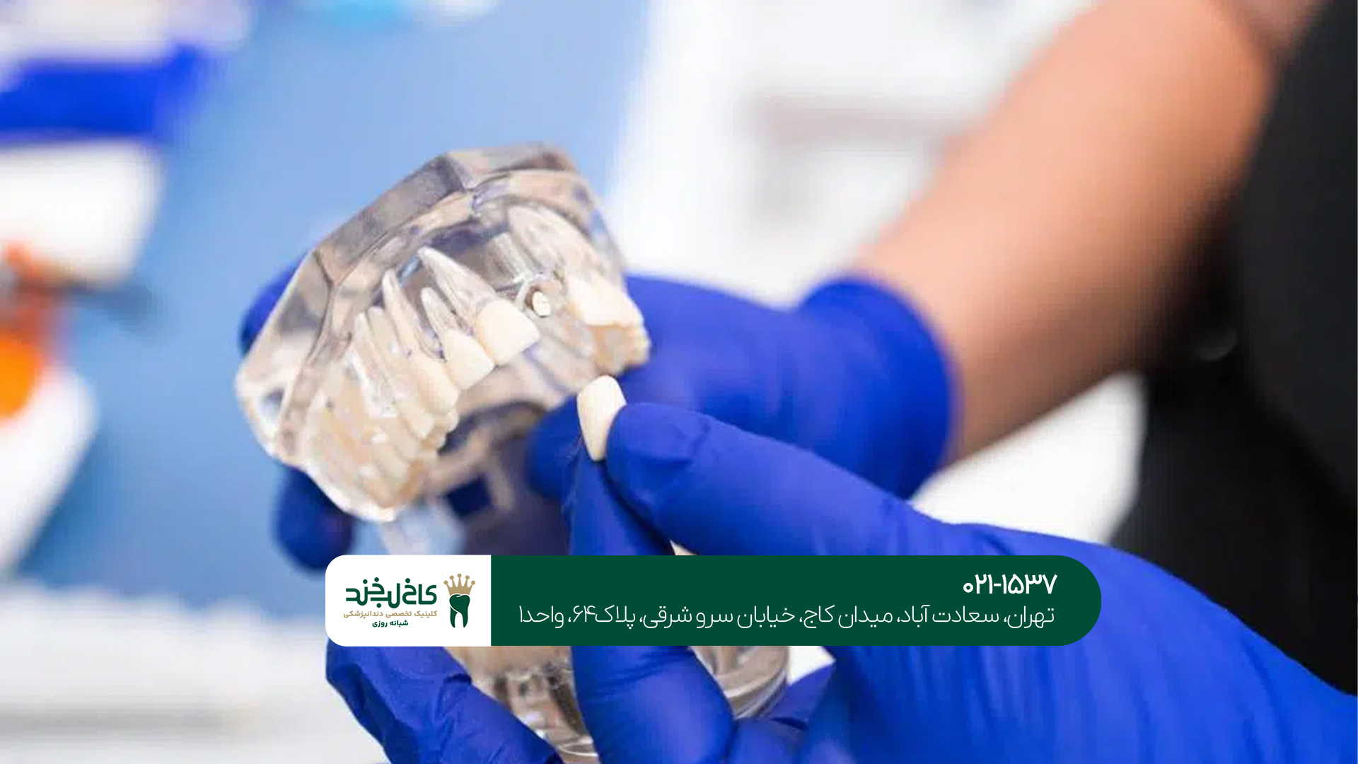 مرکز تخصصی ایمپلنت دیجیتال تهران مرکز تخصصی ایمپلنت دیجیتال تهران