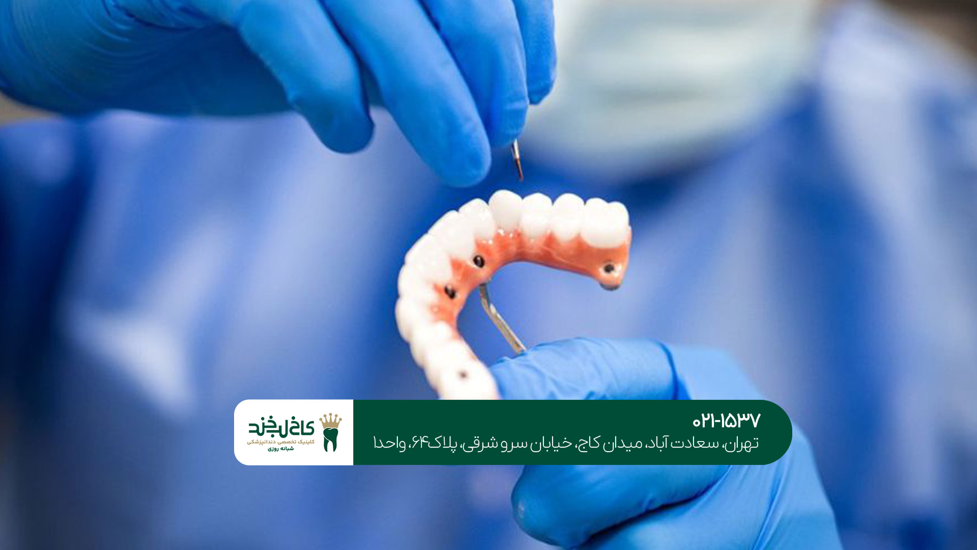 مرکز تخصصی ایمپلنت دیجیتال تهران مرکز تخصصی ایمپلنت دیجیتال تهران
