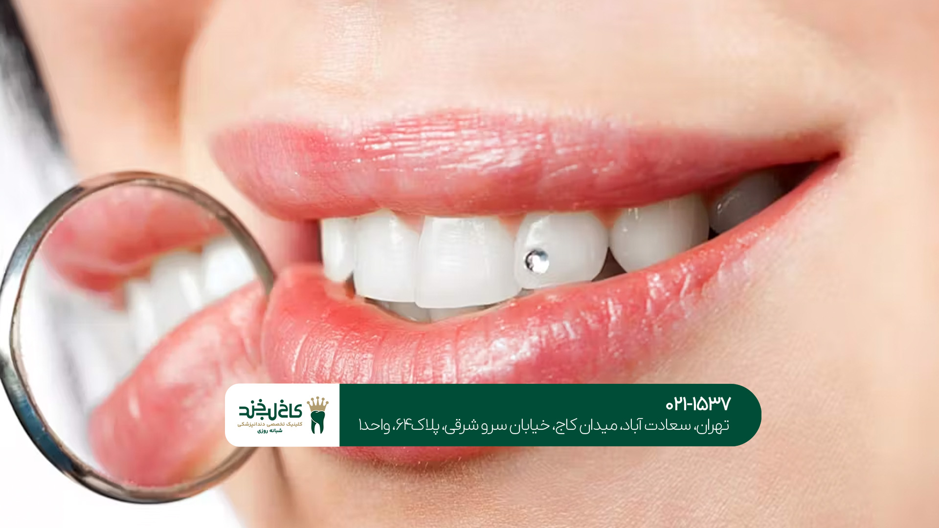 دندانپزشکی زیبایی