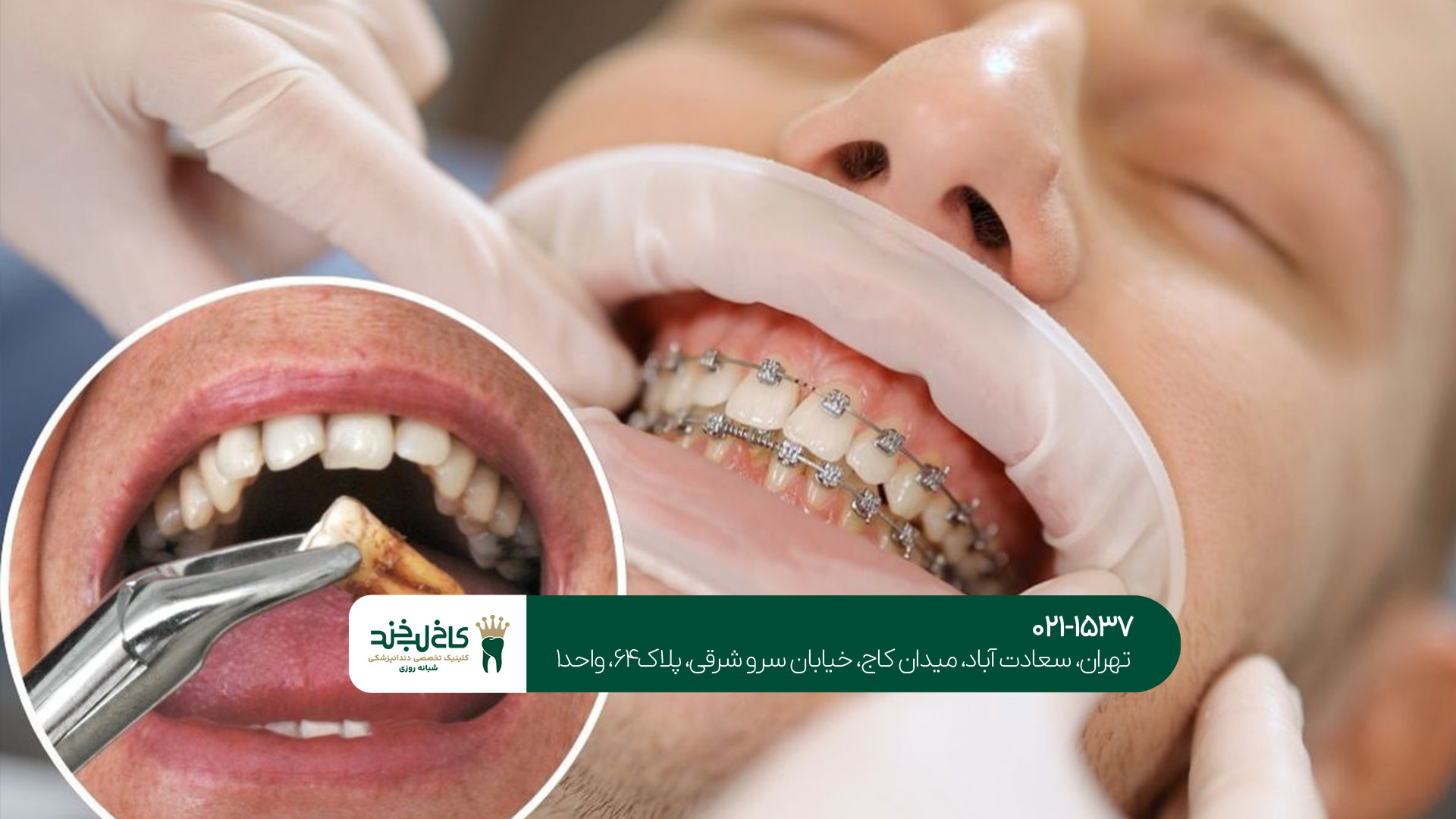 دندانپزشکی زیبایی در تهران