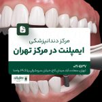 مرکز دندانپزشکی ایمپلنت در مرکز تهران