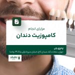 مزایای انجام کامپوزیت دندان