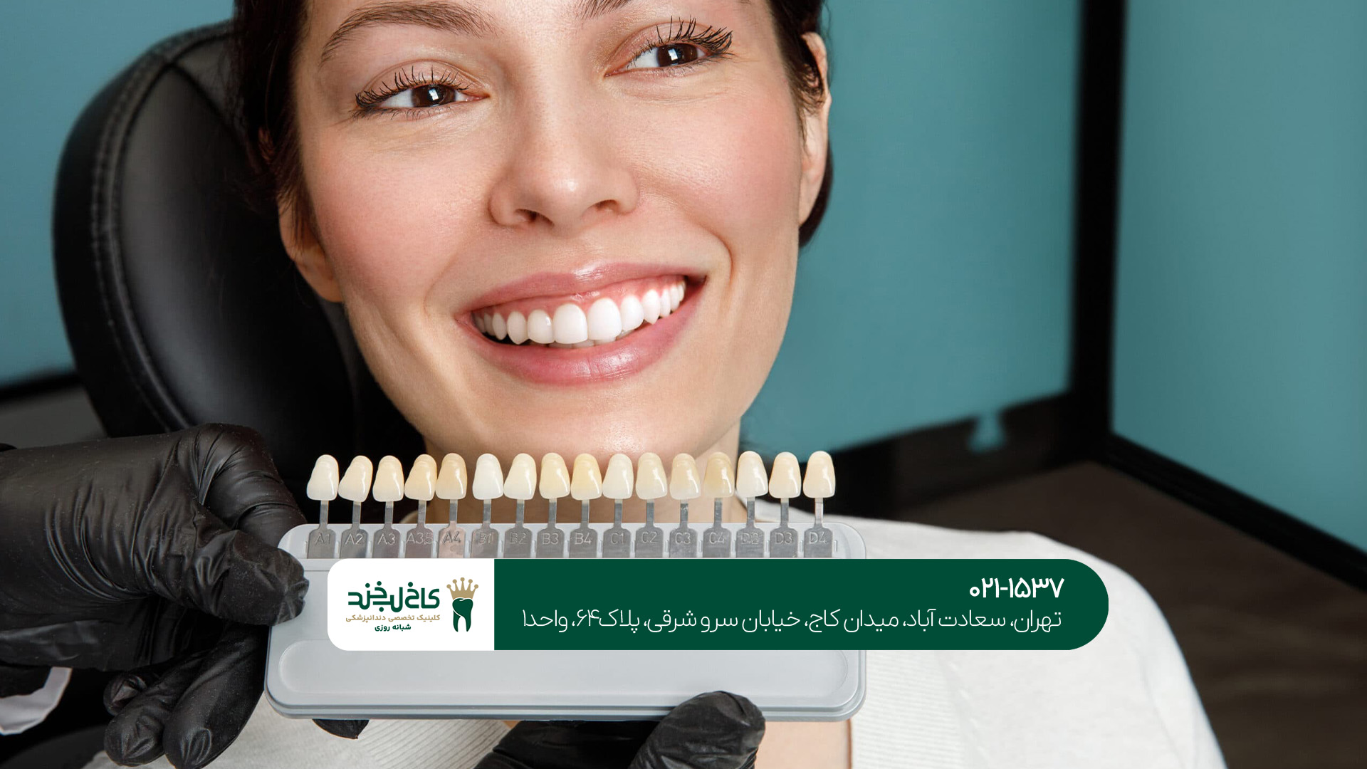 مزایای انجام کامپوزیت دندان