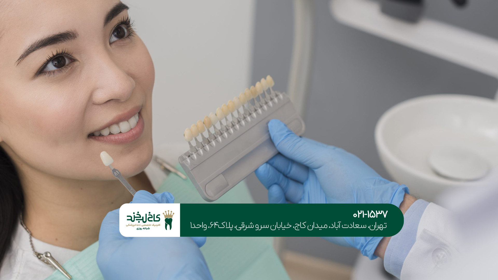 مزایای انجام کامپوزیت دندان