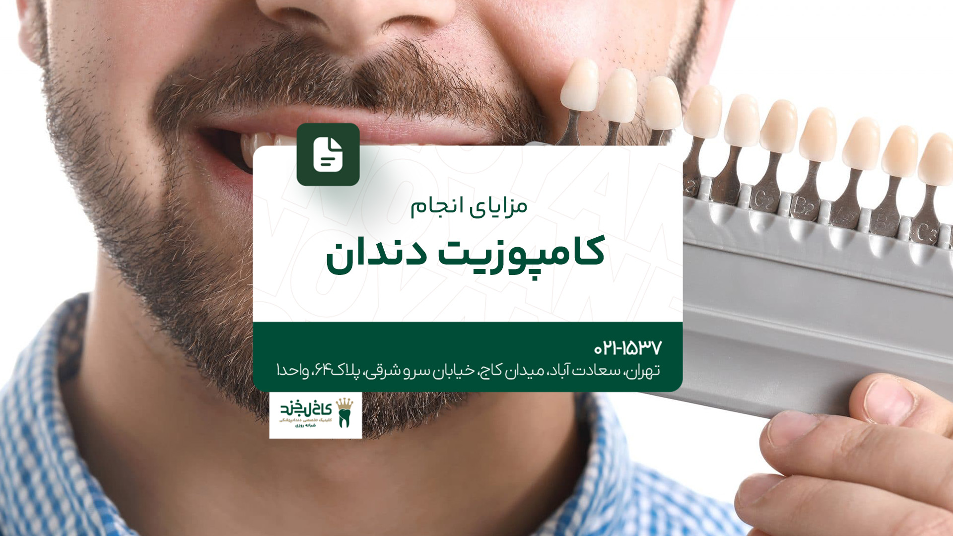 مزایای انجام کامپوزیت دندان