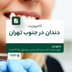 کامپوزیت دندان در جنوب تهران