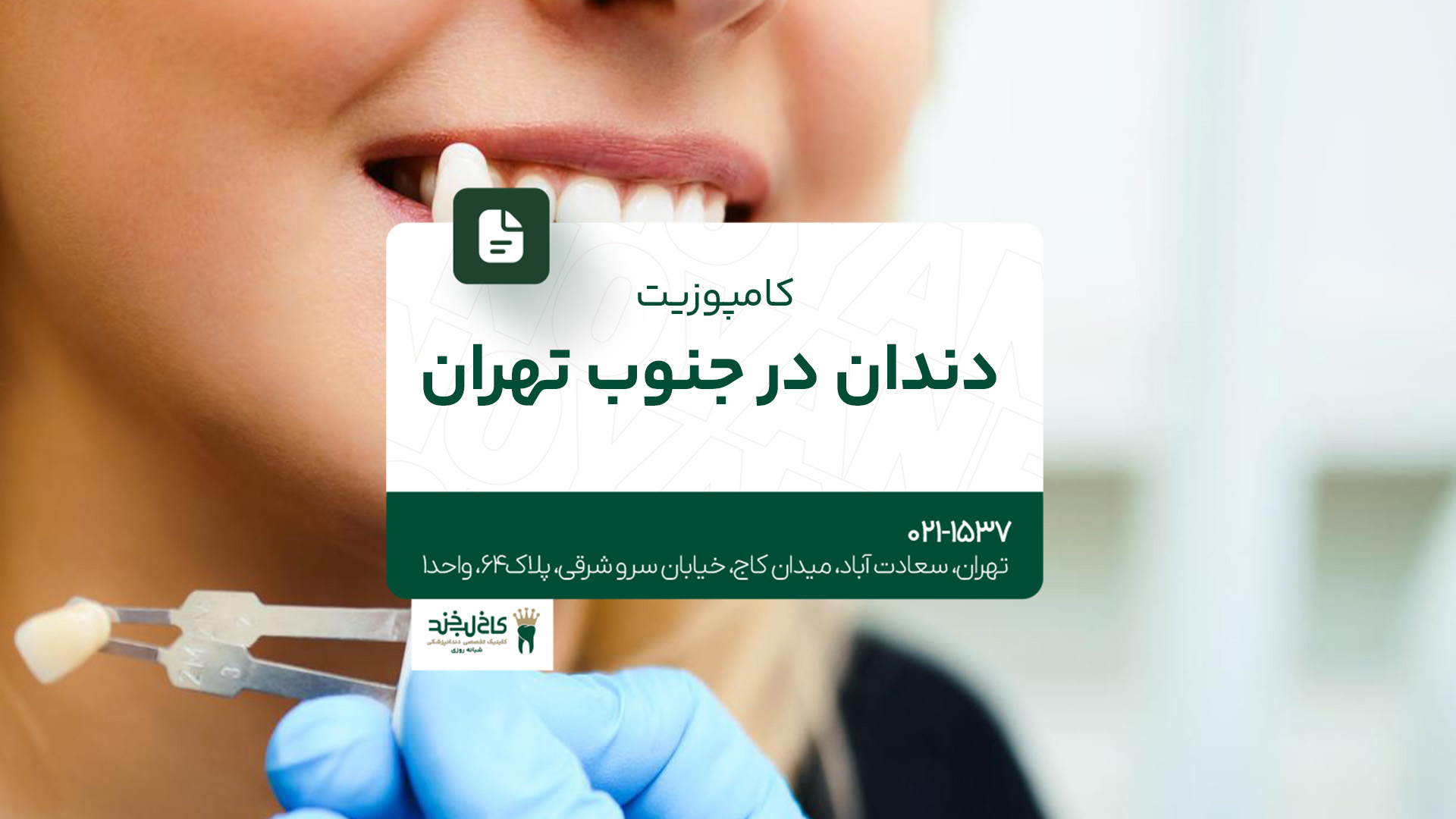 کامپوزیت دندان در جنوب تهران کامپوزیت دندان در جنوب تهران