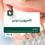 کامپوزیت ونیر