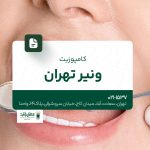 کامپوزیت ونیر تهران