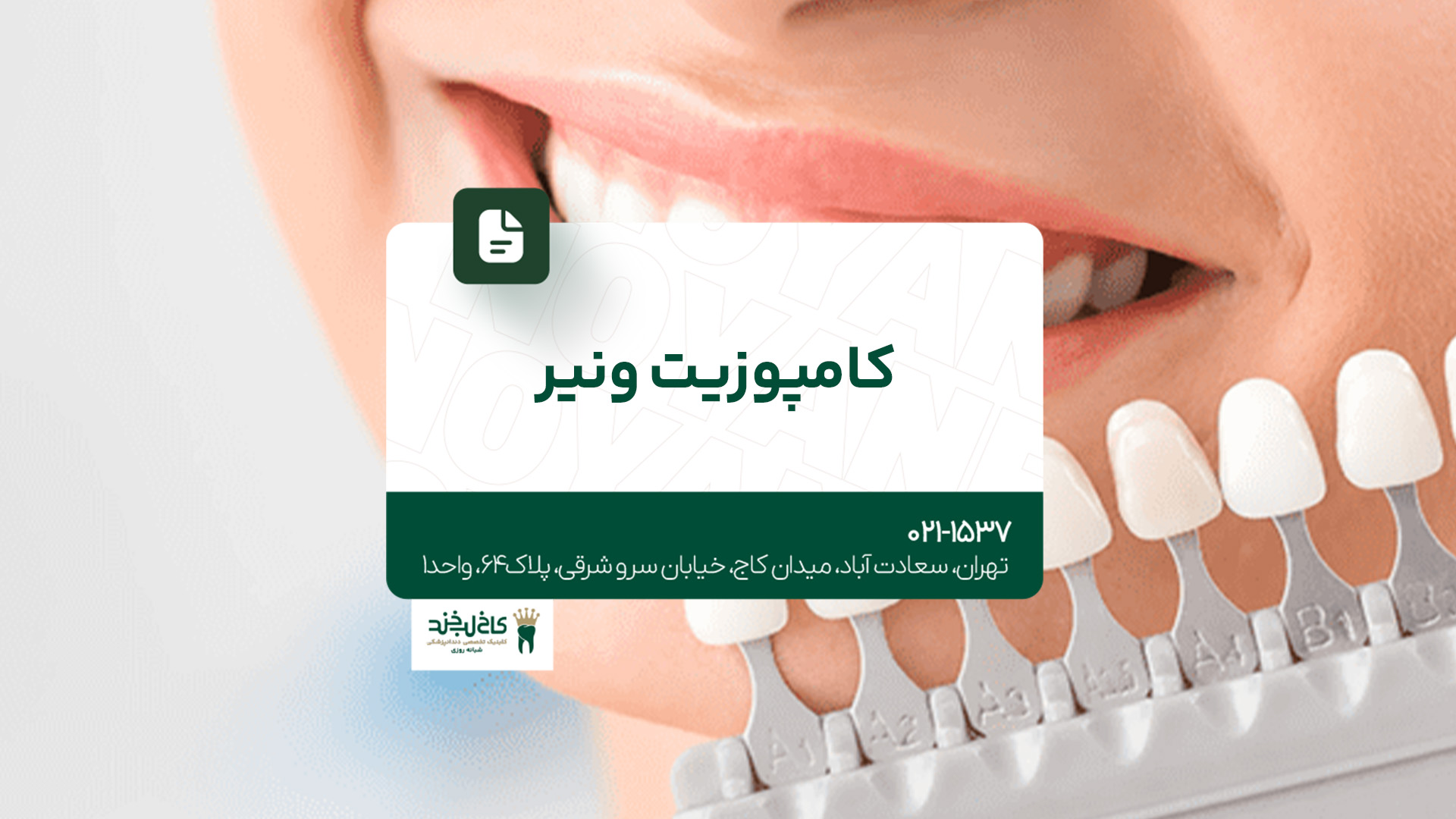 کامپوزیت ونیر کامپوزیت ونیر