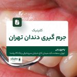 کلینیک جرمگیری دندان تهران