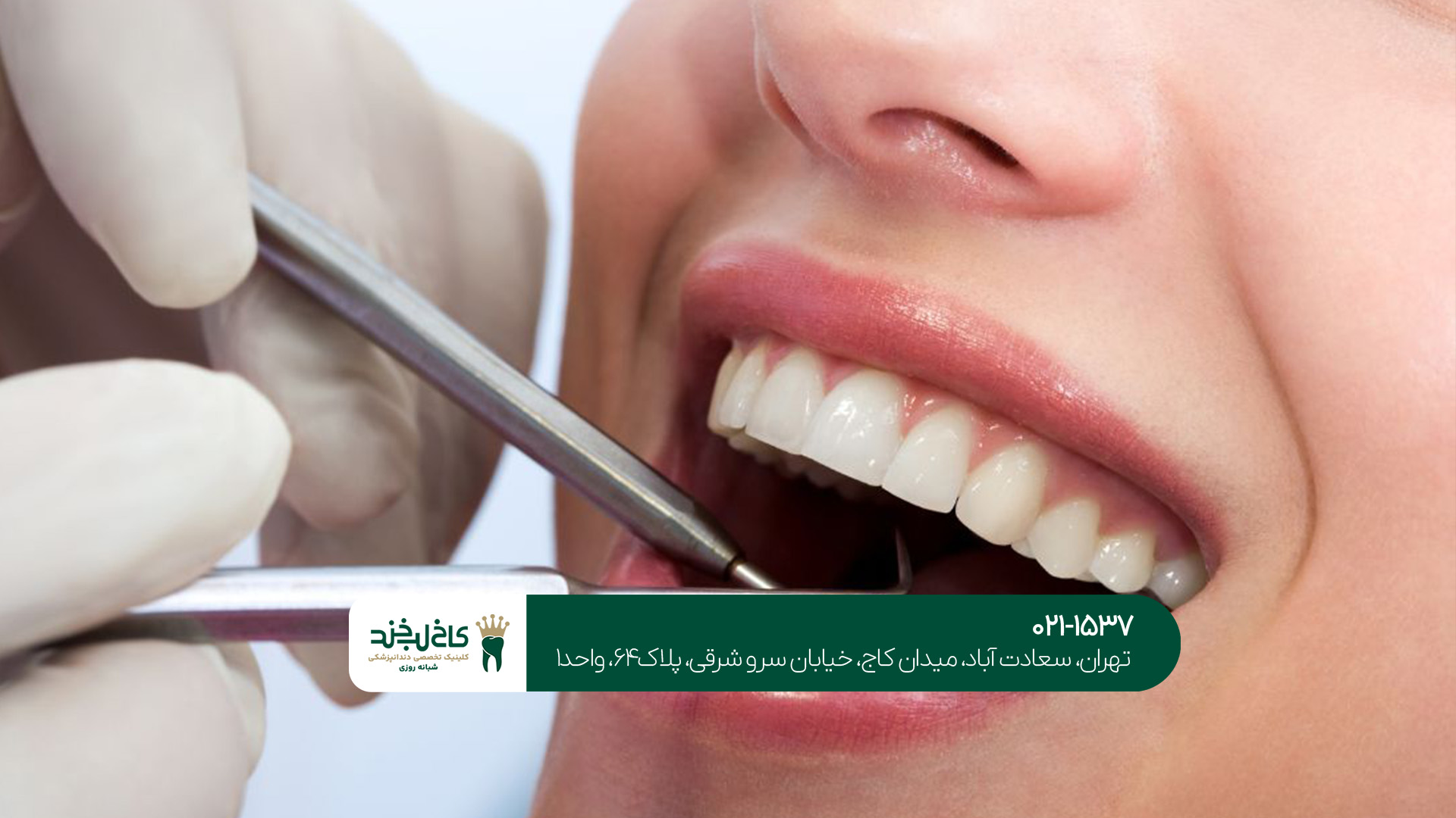 کلینیک جرمگیری دندان تهران کلینیک جرمگیری دندان تهران