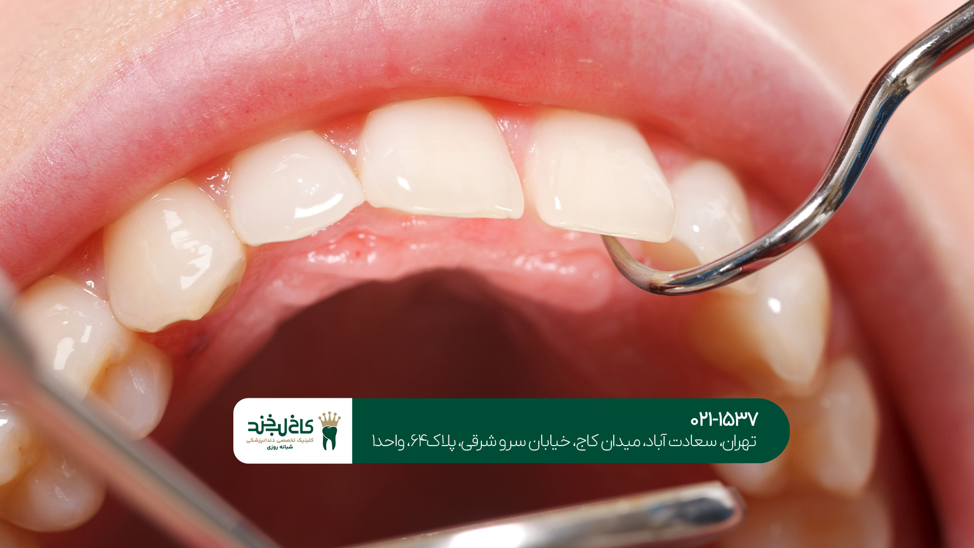 کلینیک جرمگیری دندان تهران کلینیک جرمگیری دندان تهران