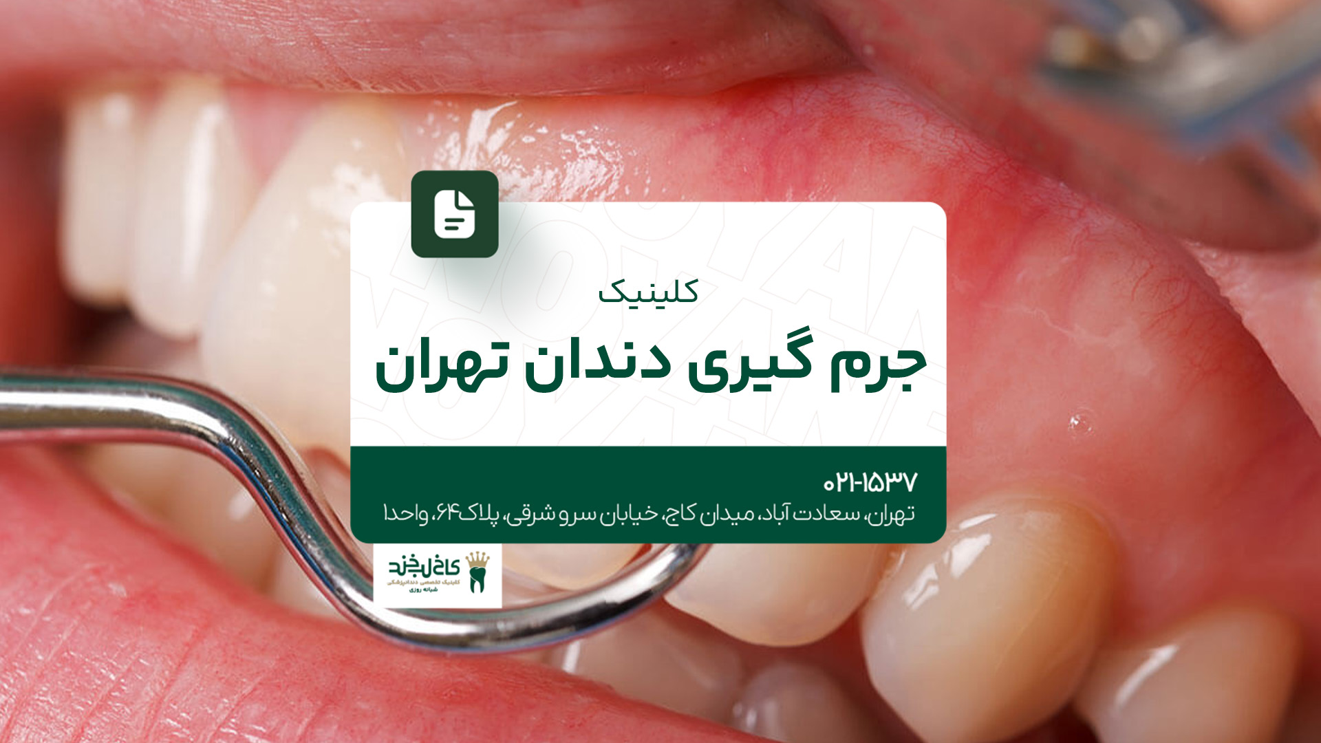 کلینیک جرمگیری دندان تهران کلینیک جرمگیری دندان تهران