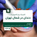 کلینیک برتر کامپوزیت دندان در تهران