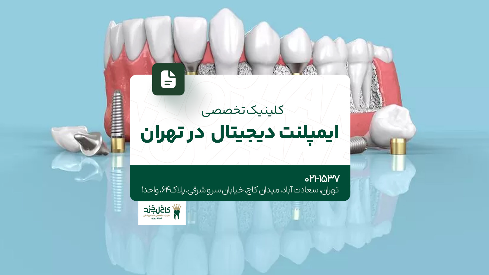 کلینیک تخصصی ایمپلنت دیجیتال در تهران