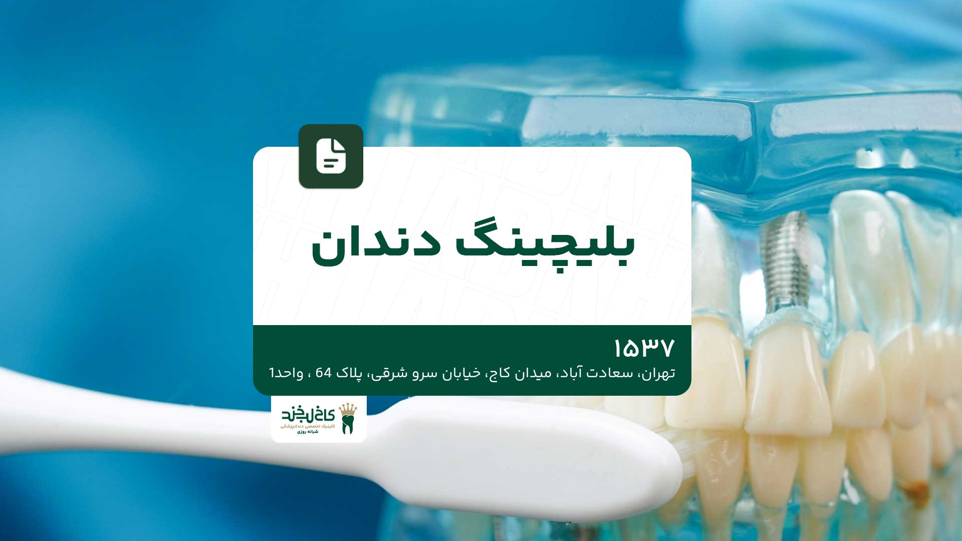 بلیچینگ دندان