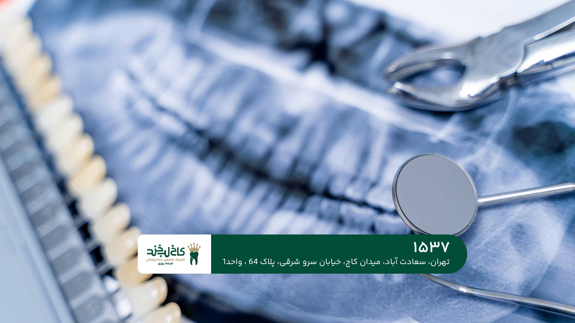 لمینت و کامپوزیت تخصصی در شمال تهران لمینت و کامپوزیت تخصصی در شمال تهران