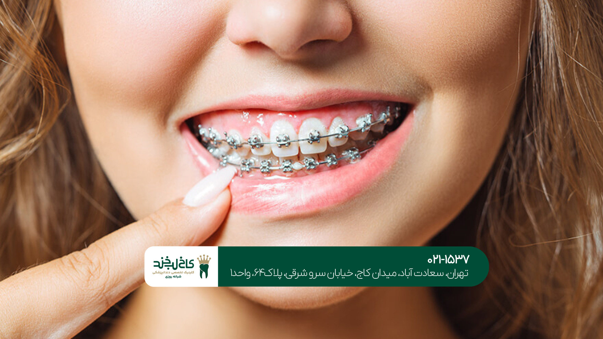 ارتودنسی تخصصی دندان در تهران ارتودنسی تخصصی دندان در تهران