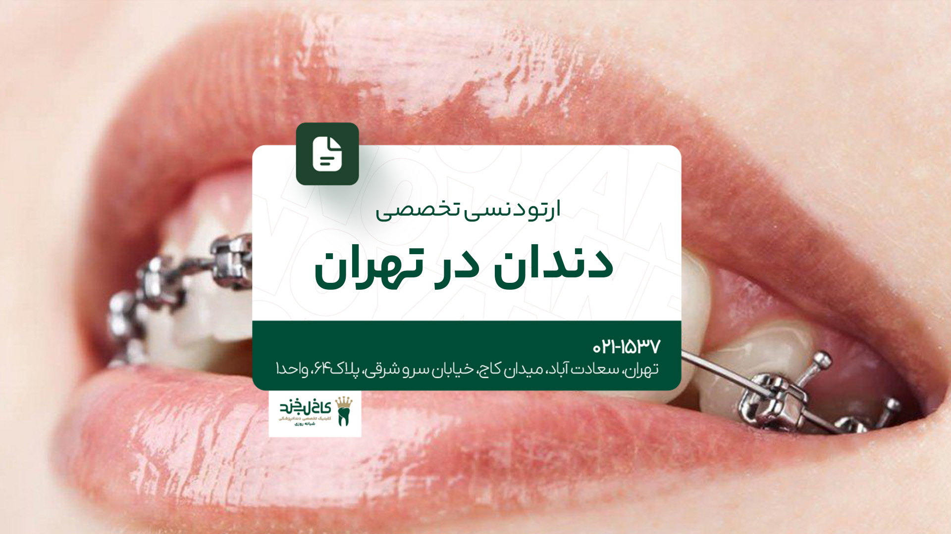 ارتودنسی تخصصی دندان در تهران ارتودنسی تخصصی دندان در تهران