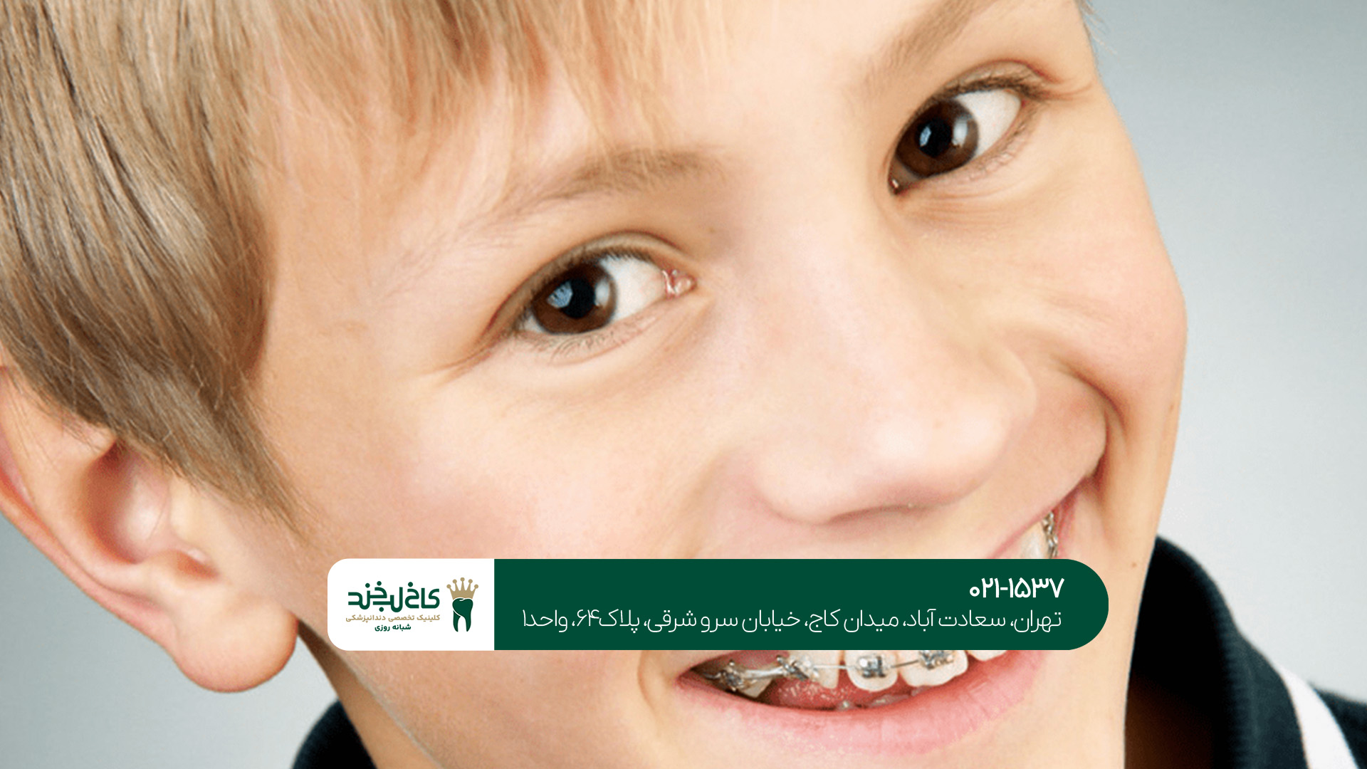 ارتودنسی دندان برای کودکان ارتودنسی دندان برای کودکان