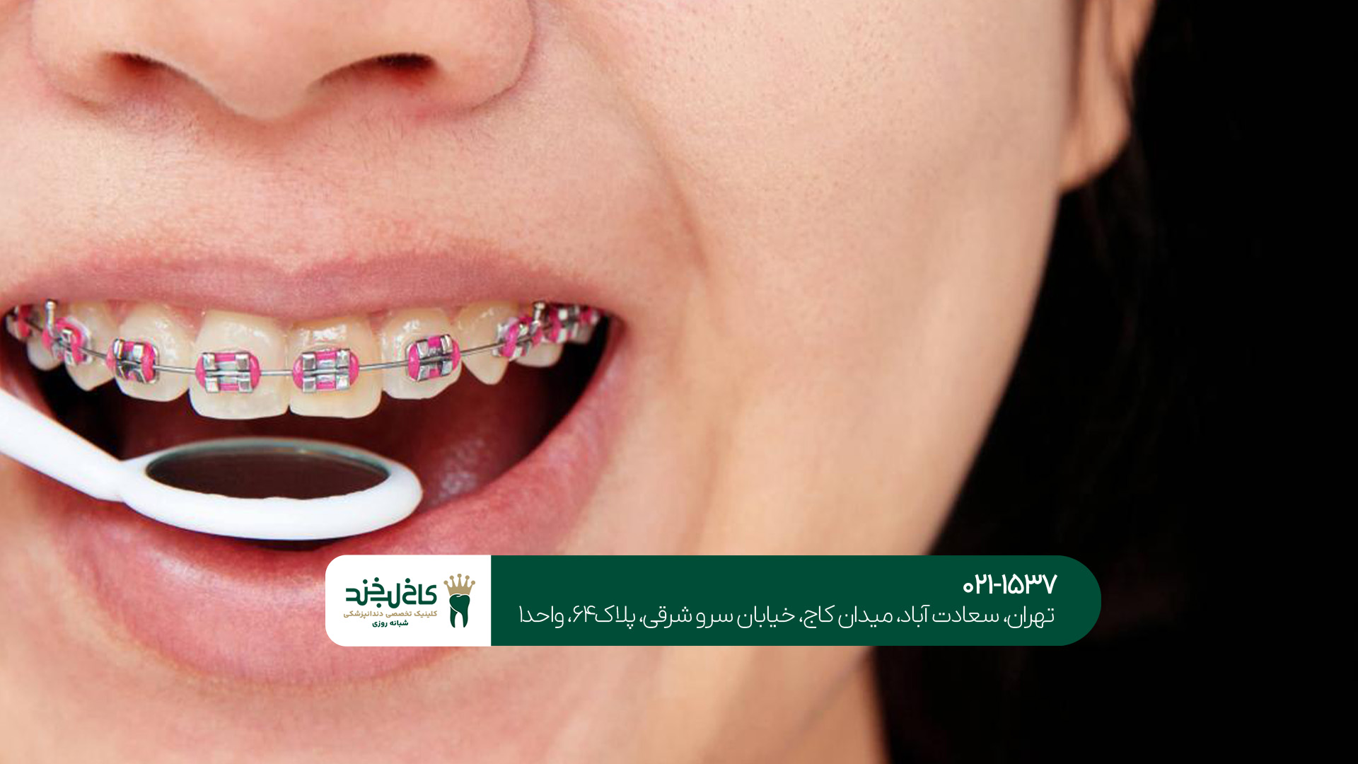 ارتودنسی تخصصی دندان در تهران ارتودنسی تخصصی دندان در تهران