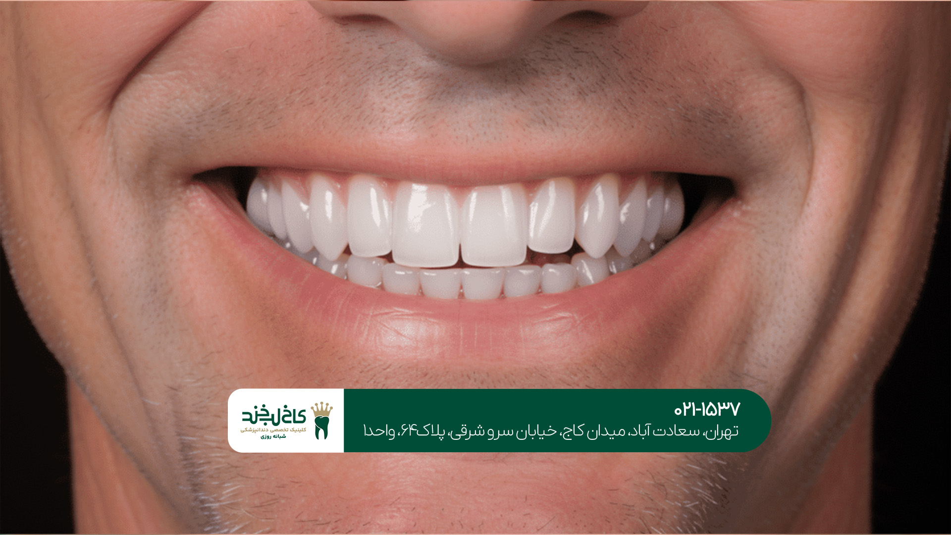 اصلاح تخصصی طرح لبخند در تهران اصلاح تخصصی طرح لبخند در تهران