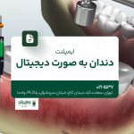 ایمپلنت دندان به صورت دیجیتال