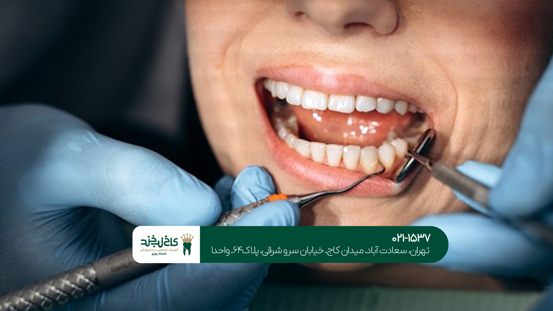 برترین دندانپزشکی در غرب تهران برترین دندانپزشکی در غرب تهران
