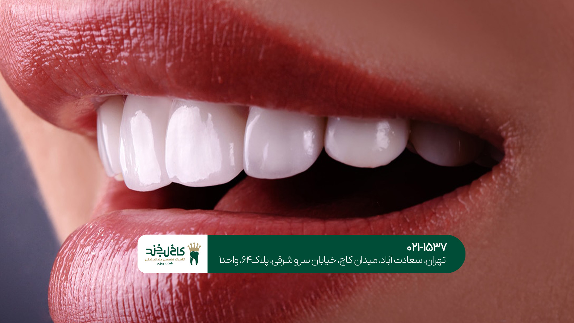 برترین کلینیک درمان و زیبایی دندان برترین کلینیک درمان و زیبایی دندان