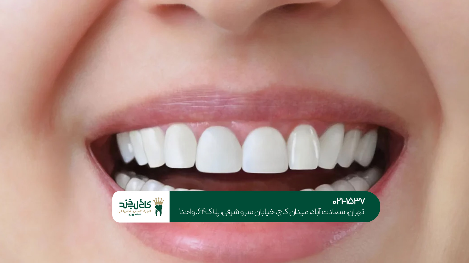 برترین کلینیک درمان و زیبایی دندان برترین کلینیک درمان و زیبایی دندان