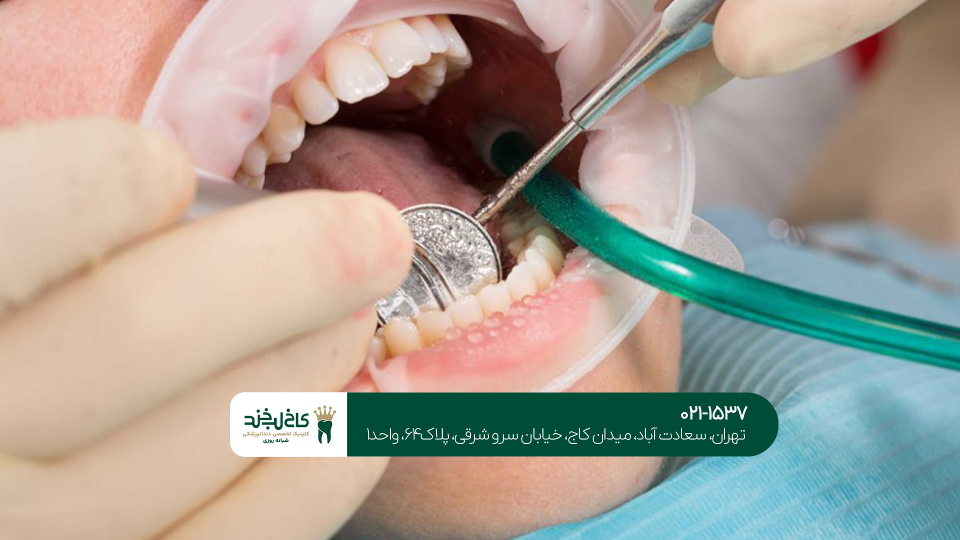 برترین کلینیک درمان و زیبایی دندان برترین کلینیک درمان و زیبایی دندان