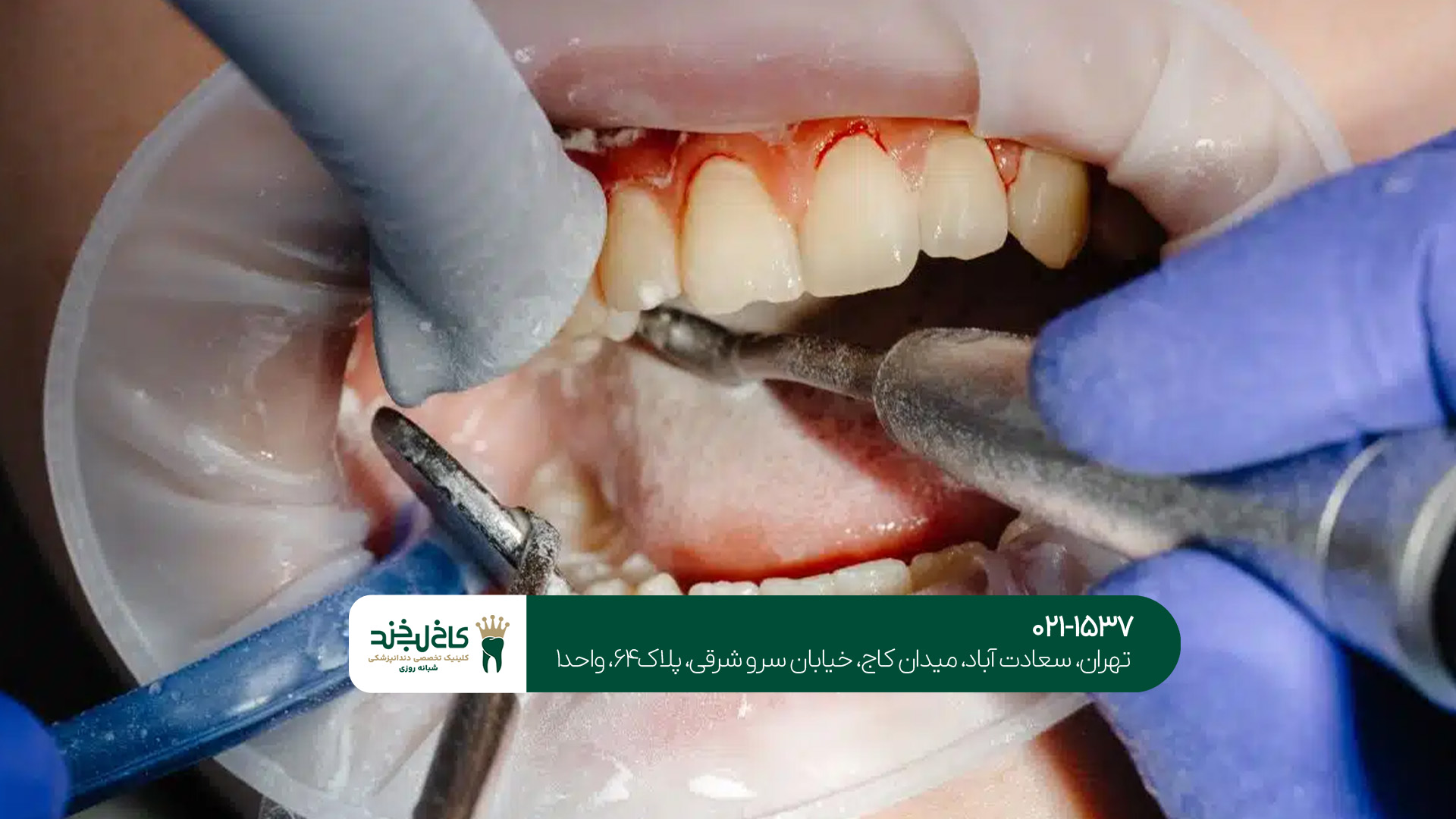 دندانپزشکی در تهران دندانپزشکی در تهران